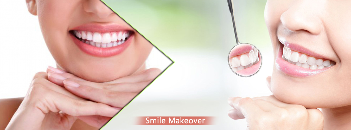 Best Smile Makeover Clinic In Pune