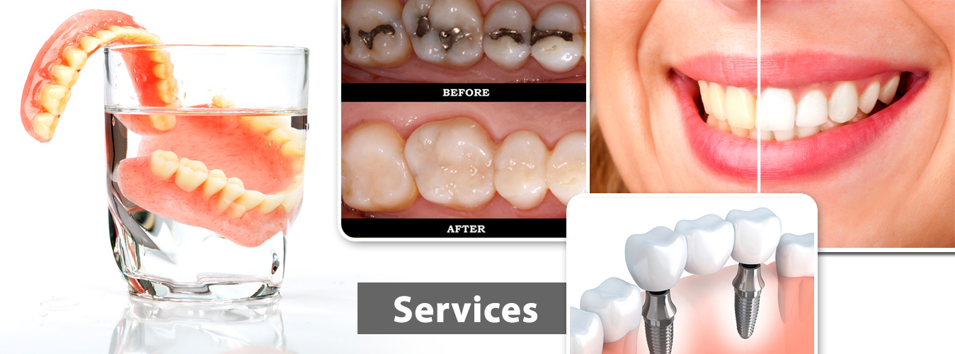 Best Dentist In Hinjewadi Pune