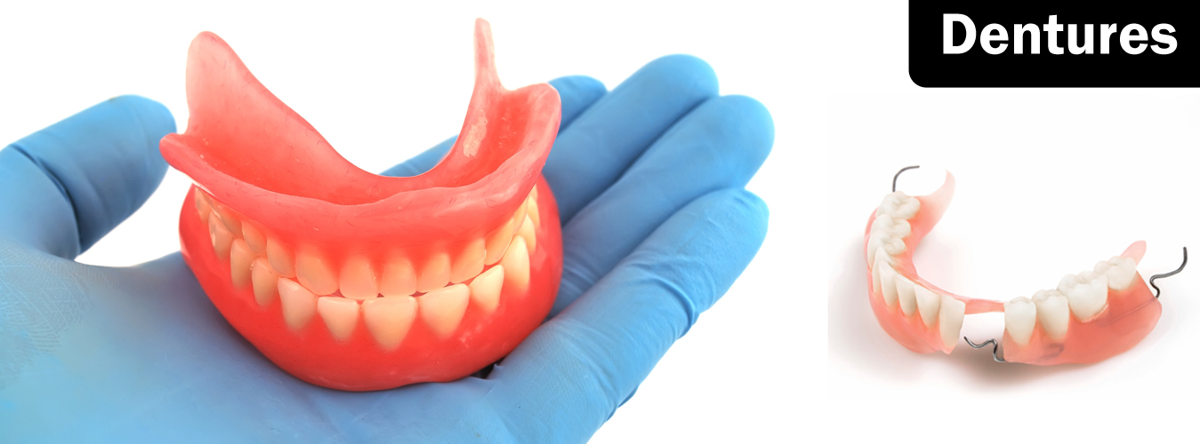 Best Dentures Treatment in Pune