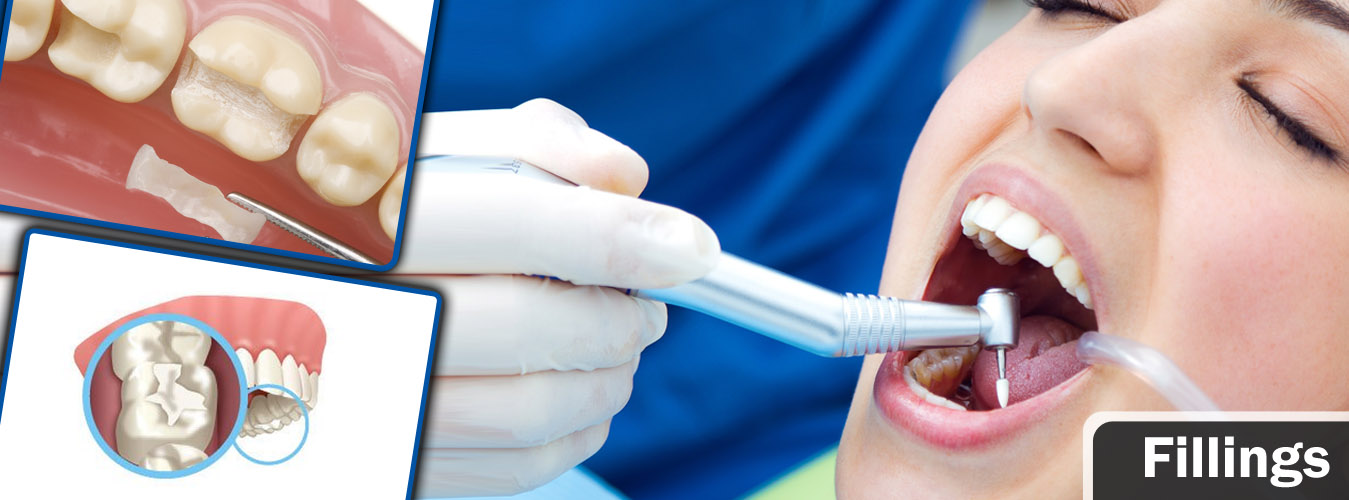 Cosmetic Filling Treatments In Pune